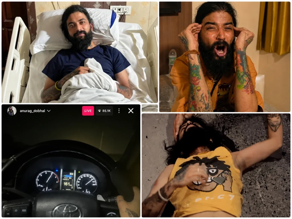 Anurag Dobhal Accident